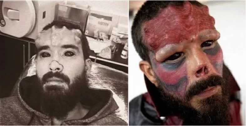 Cortou o nariz para parecer com o vilão Caveira Vermelha