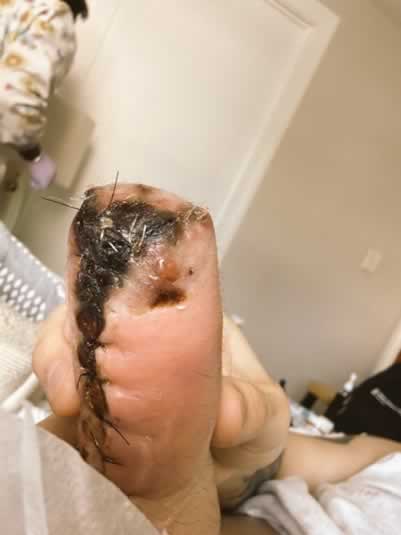 Cirurgia de redesignação de gênero é uma automutilação genital baseada no engano 22